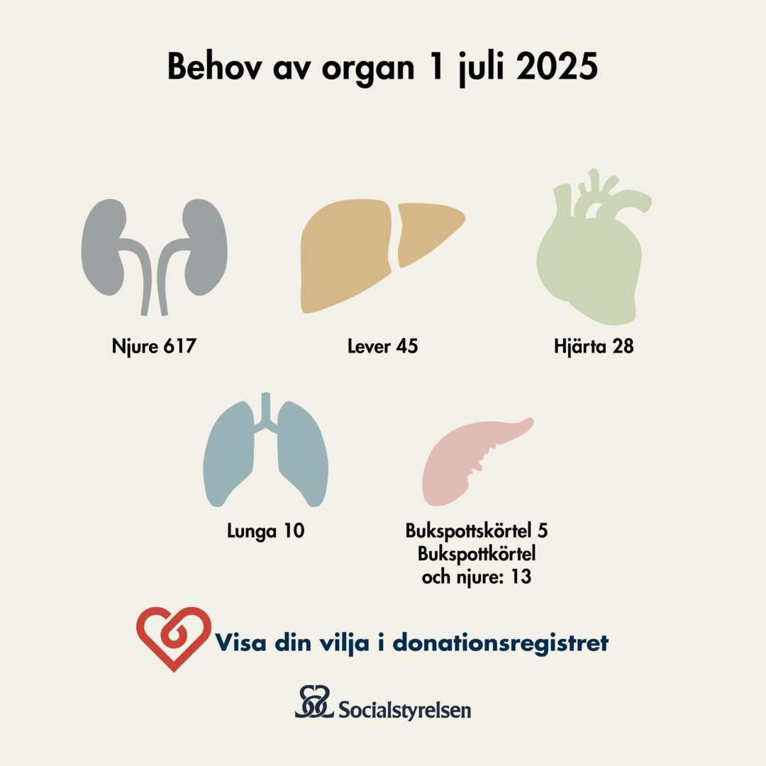 Så många väntar på organ juli 2025